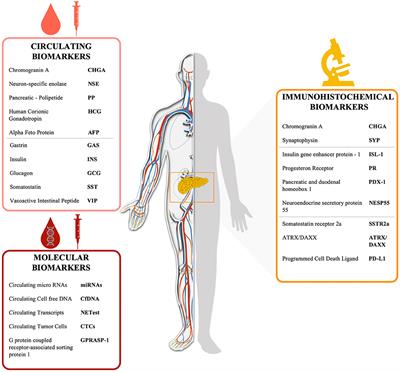 Biomarkers for Pancreatic Neuroendocrine Neoplasms (PanNENs) Management—An Updated Review